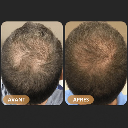 ZENKA™ - Shampoing Activateur de Pousse