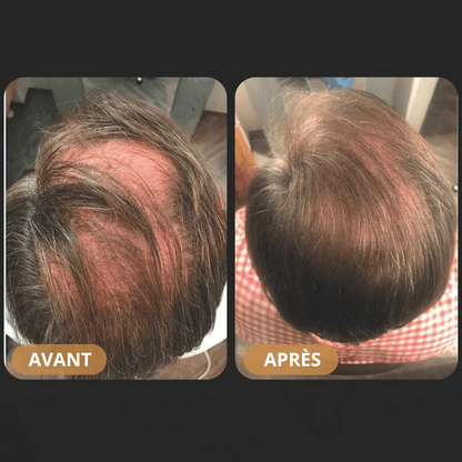 ZENKA™ - Shampoing Activateur de Pousse