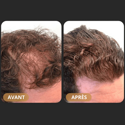 ZENKA™ - Shampoing Activateur de Pousse